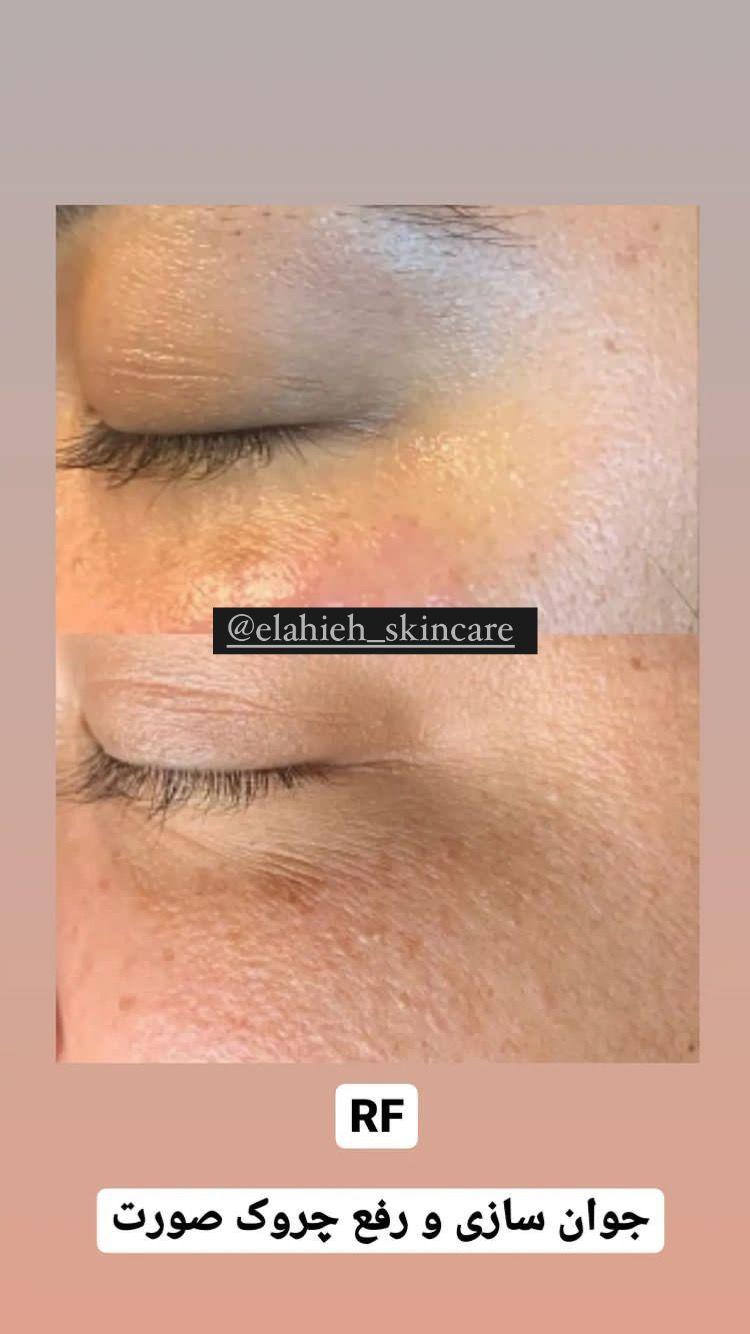 پاکسازی پوست و درمان مشکلات پوستی