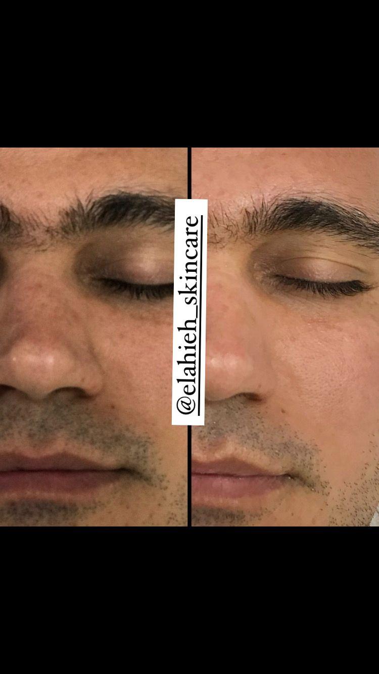 پاکسازی پوست و درمان مشکلات پوستی