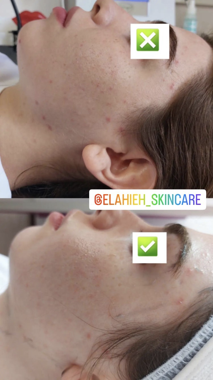 پاکسازی پوست و درمان مشکلات پوستی