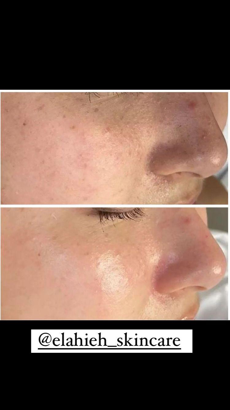 پاکسازی پوست و درمان مشکلات پوستی