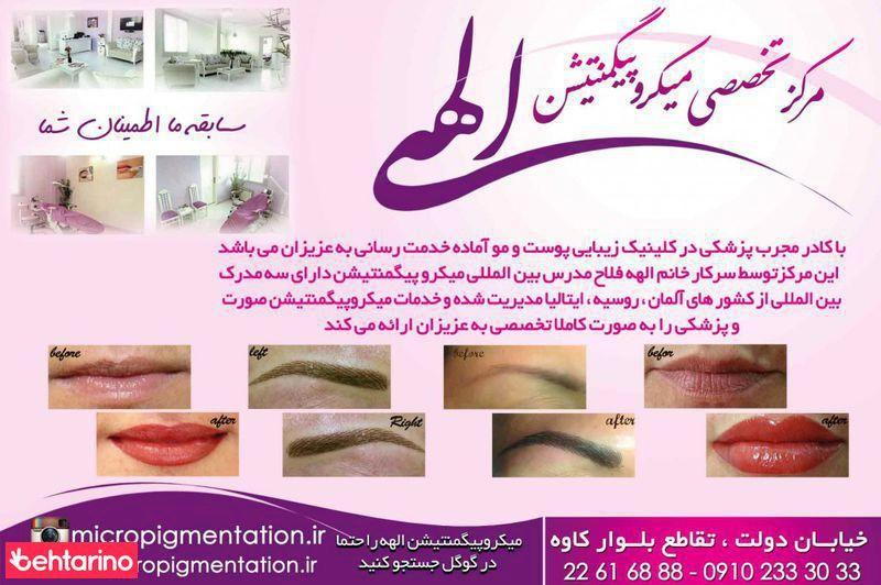 مرکز فوق تخصصی میکروپیگمنتیشن الهه